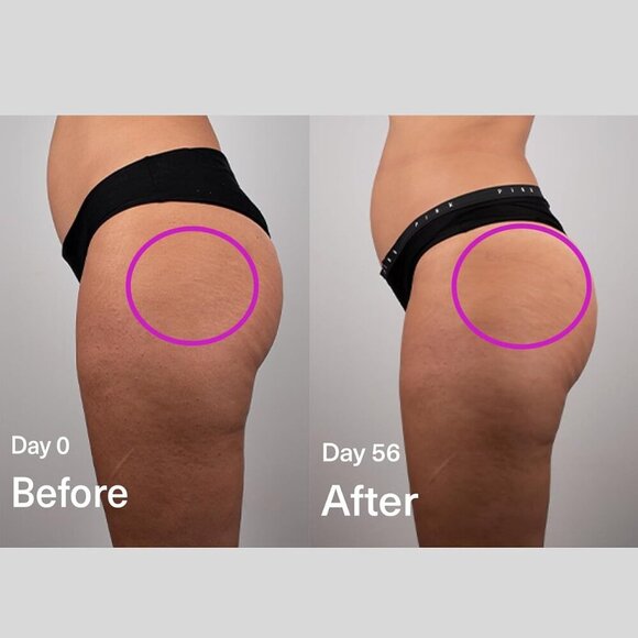 SickScience DropOff Body Sculpting Gel Serum – Biohacking Beauty - Picture 9 of 9